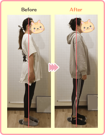 I様30代女性のビフォーアフター