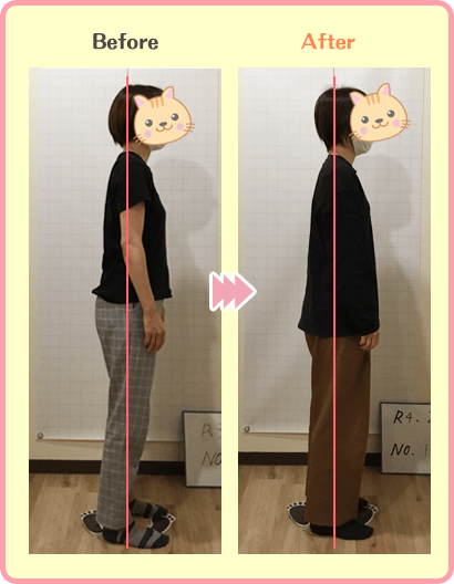 M様30代女性のビフォーアフター