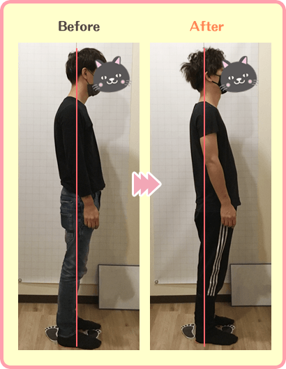 T様の姿勢のビフォーアフター