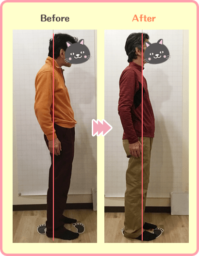 M様、施術前後の姿勢の様子